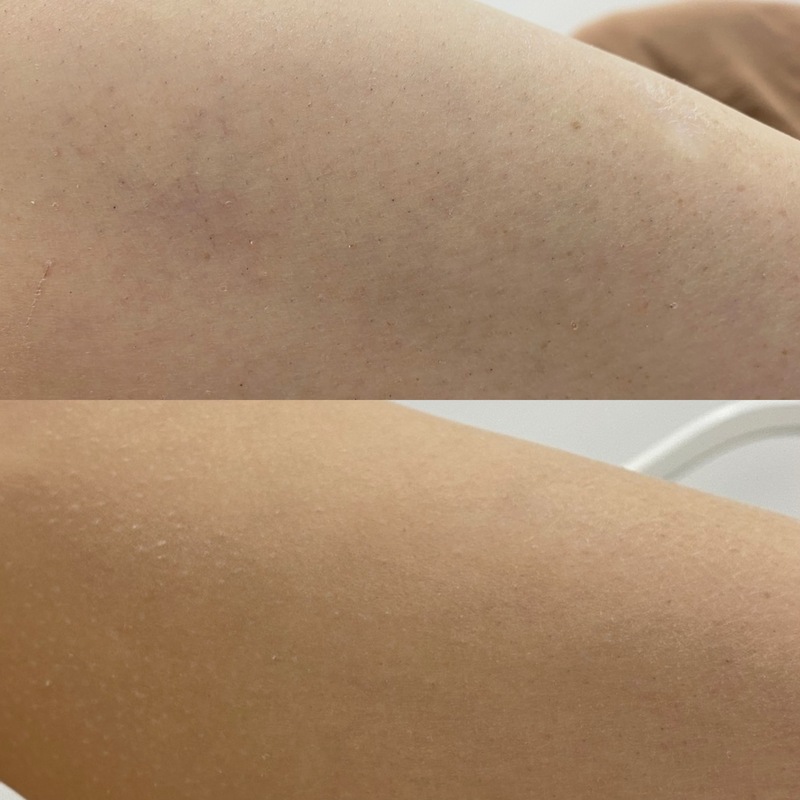 Лікар: Вигнанська Віра Кількість процедур: 2