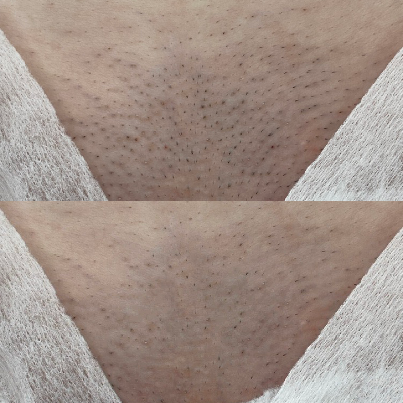 Врач: Вигнанская Вера Количество процедур: 1