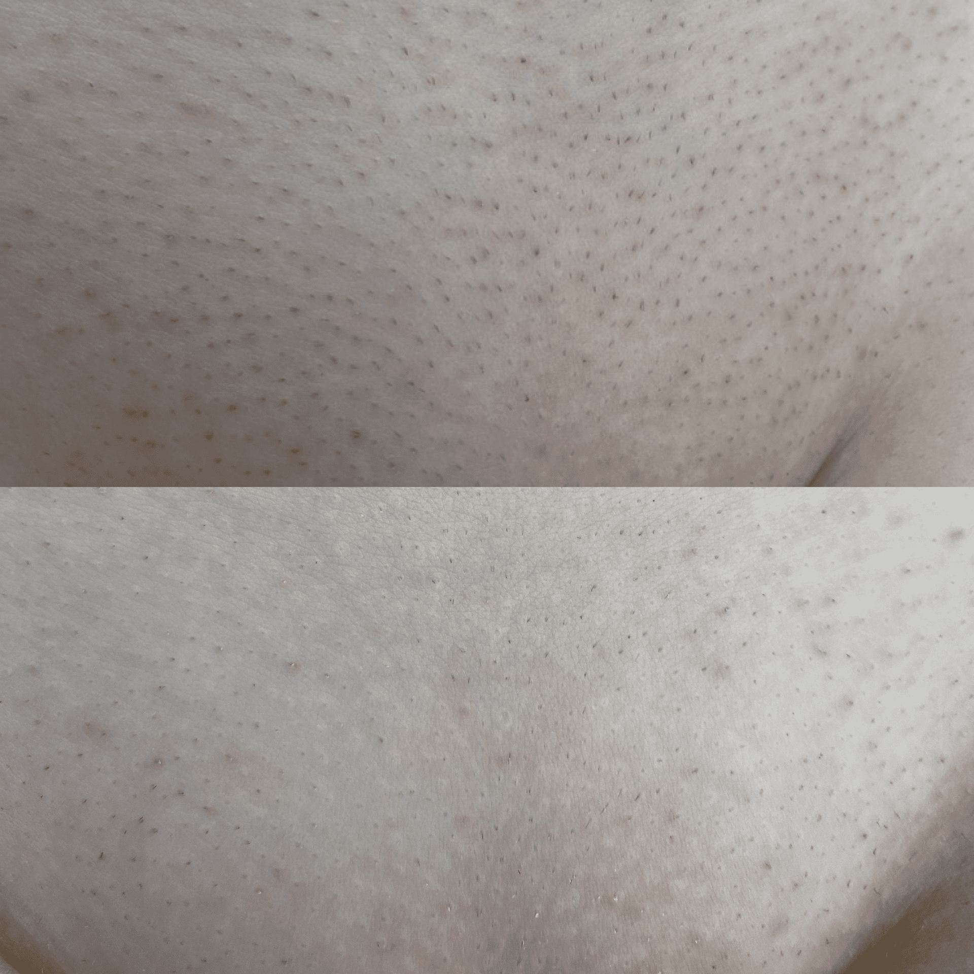 Врач: Вигнанская Вера Количество процедур: 4