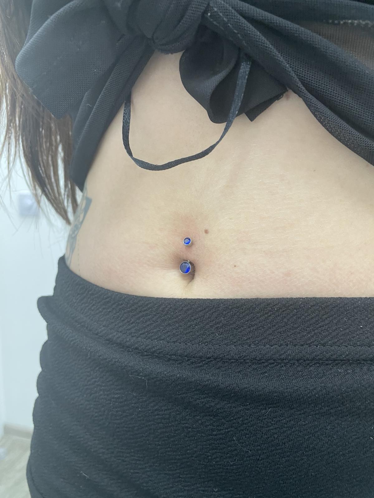 Procedure: Piercing (Navel Piercing) Method: Needle Piercing Surgeon: Svyatoslav Syniuk