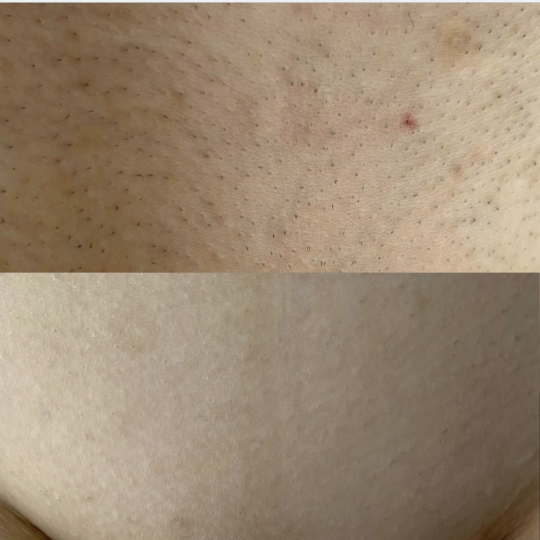 Врач: Триндяк Елена Количество процедур: 3