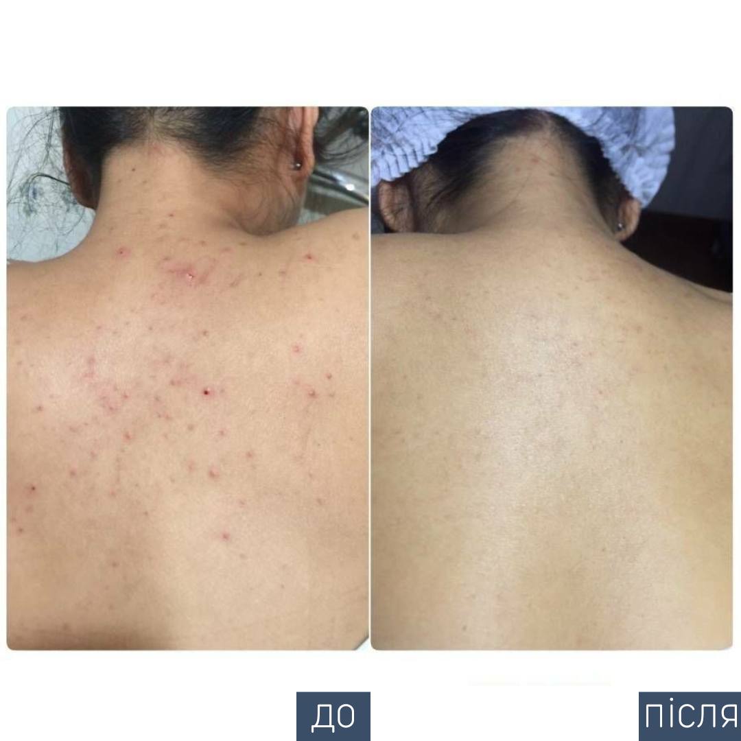 Процедура: консультація дієтолога