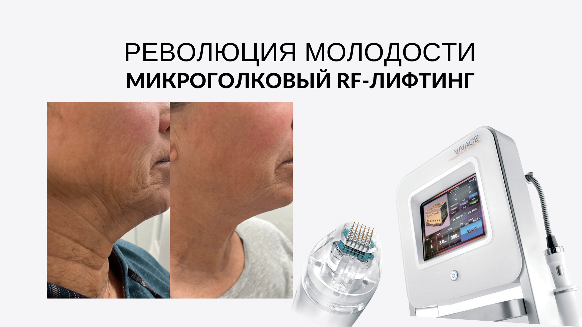 Mediostar - Lviv - 21-1