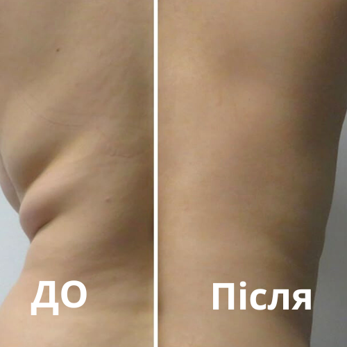 Ділянка: спина Кількість процедур: 3